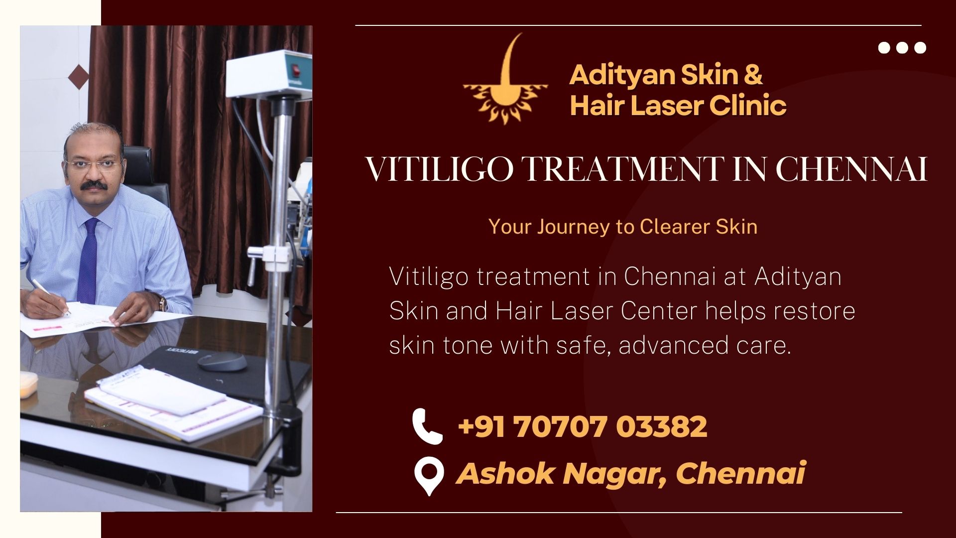 Vitiligo treatment in Chennai at Adityan Skin and Hair Laser Center helps restore skin tone with safe, advanced care.