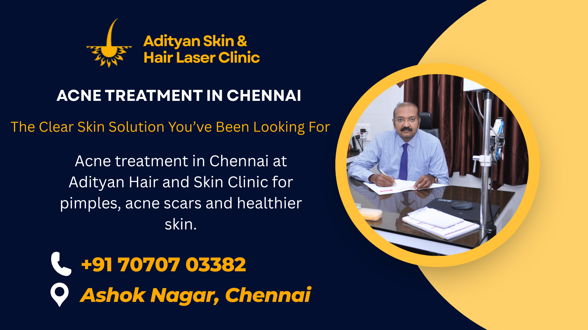 acne treatment in Chennai